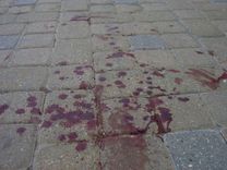 Nenoskaidrots vadītājs notriecis velosipēdistu. Policija meklē aculieciniekus