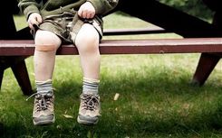 Zēni gūst traumas divreiz biežāk nekā meitenes