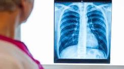 Uz rentgena izmeklējumu obligāti jāpierakstās