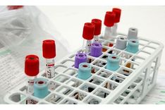 Turpmāk informāciju par COVID-19 negatīviem rezultātiem iedzīvotāji saņems E-veselības portālā